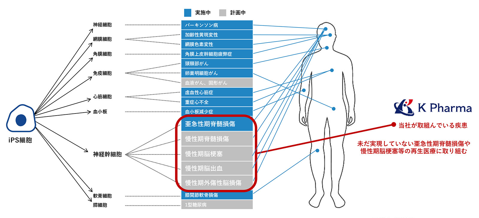 開発パイプライン｜iPS細胞を使った臨床研究・治験(再生医療)の状況